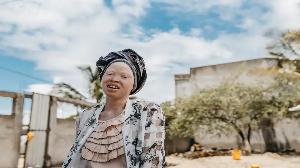 “The blood that runs in our veins is the same:” towards equal rights for persons with albinism.